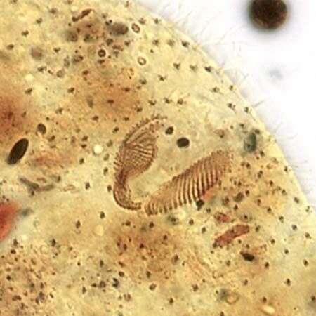 Image of reniform colpodean ciliate