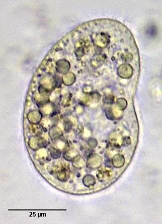 Image of reniform colpodean ciliate