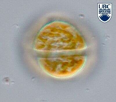 Image of dinoflagellates