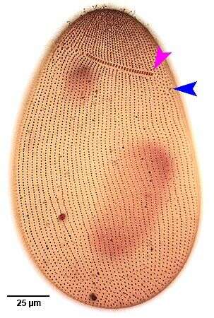 Imagem de Nassulopsis elegans (Ehrenberg 1834) Foissner, Berger & Kohmann 1994