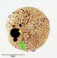 Image of Urotricha platystoma Stokes 1886