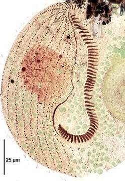 Image de Blepharisma lateritium (Ehrenberg 1831) Stein 1859