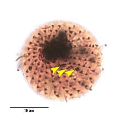 Image of Urotricha farcta Claparède & Lachmann 1859