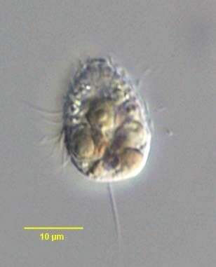 Image of Urotricha farcta Claparède & Lachmann 1859