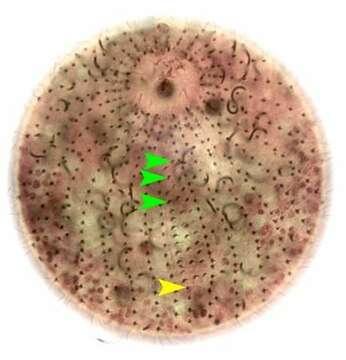 Image of Pelagothrix Foissner, Berger & Schaumburg 1999