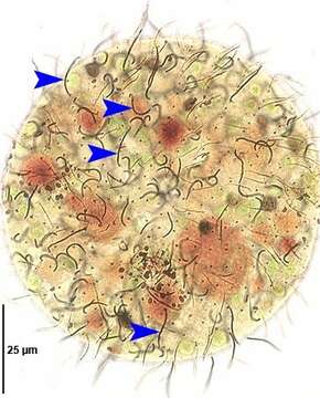 Image of Pelagothrix Foissner, Berger & Schaumburg 1999