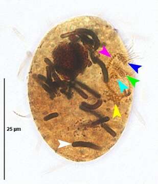 Image of Dexiotrichides centralis (Stokes 1885) Kahl 1931