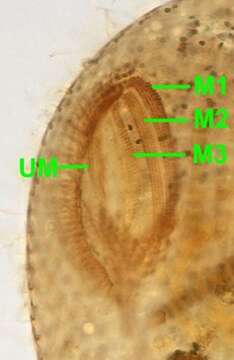 Image of Frontonia acuminata