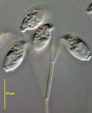 Image of Opercularia nutans (Ehrenberg 1831) Stein 1854