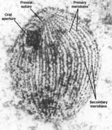 Image of Glaucoma scintillans