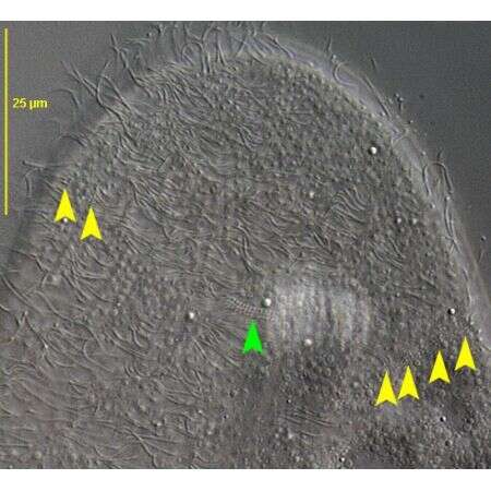 Imagem de Nassulopsis elegans (Ehrenberg 1834) Foissner, Berger & Kohmann 1994