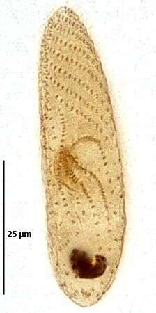 Imagem de Colpodidium caudatum