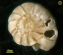 Image of Ammonia beccarii (Linnaeus 1758)