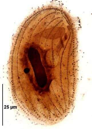 Image of Pseudomicrothorax dubius