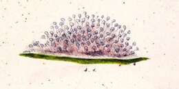 Image of Vorticella campanula