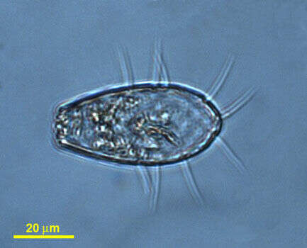 Слика од Euglyphidae