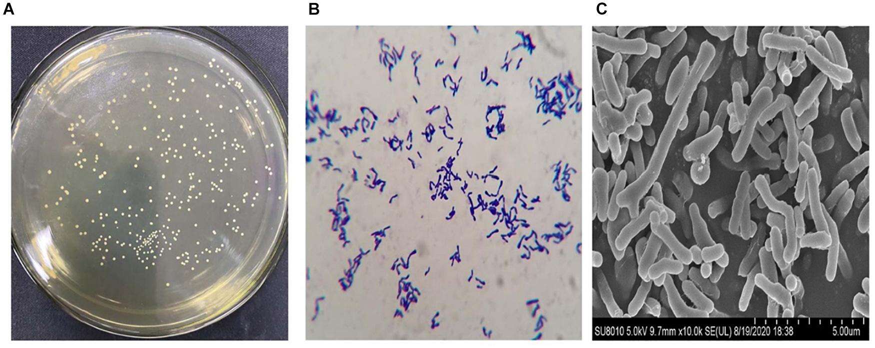 Image of Bifidobacterium bifidum