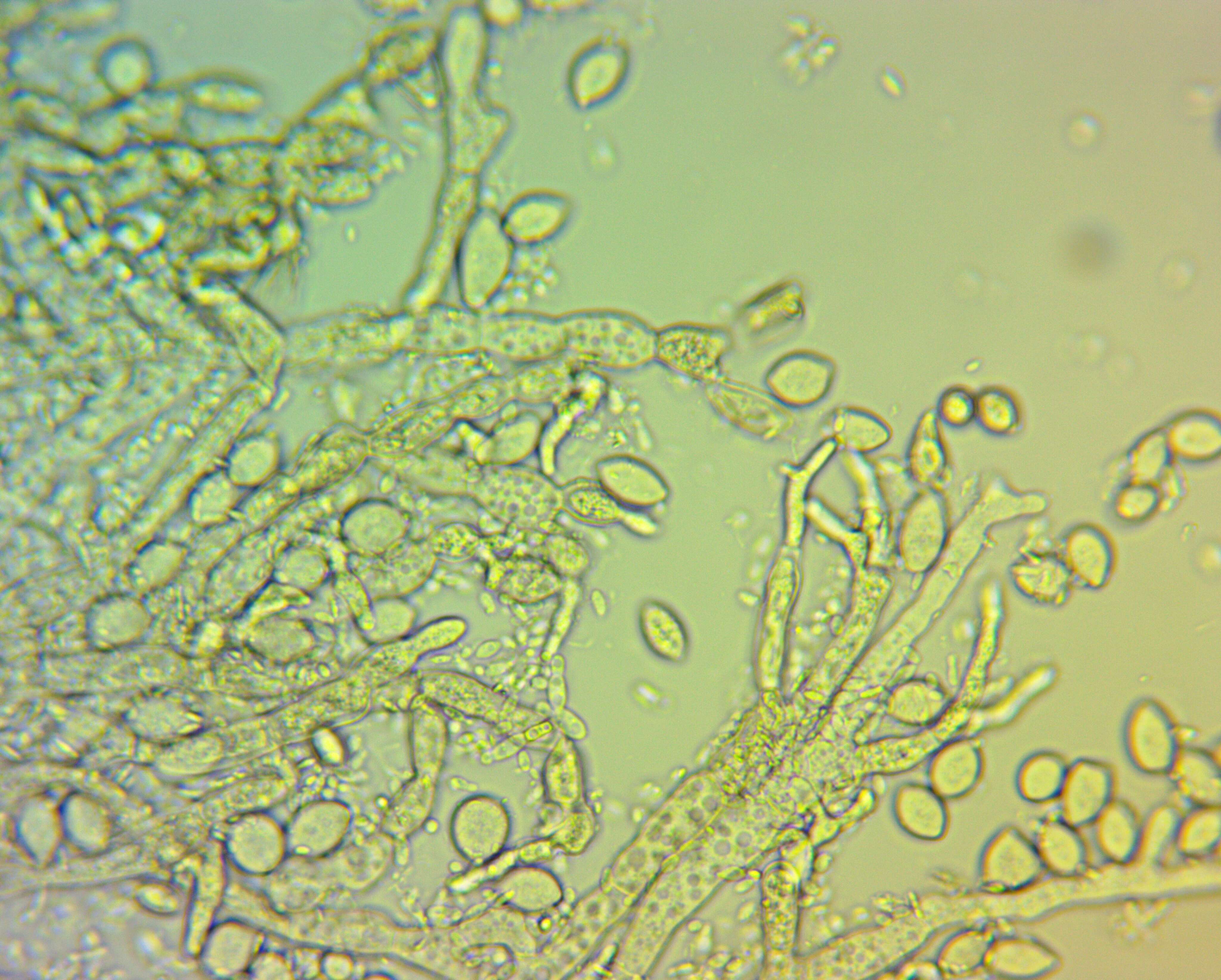 Image of Monilinia fructicola (G. Winter) Honey 1928