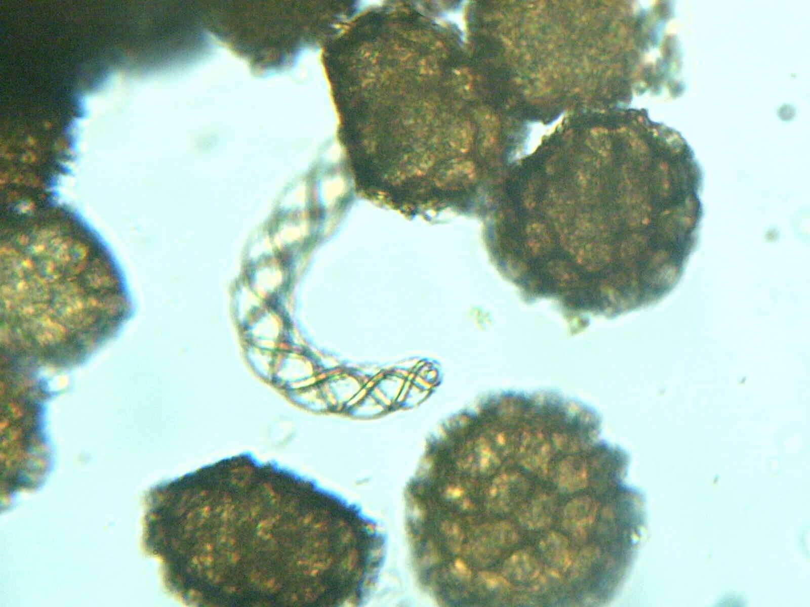 Image of Fossombronia foveolata Lindb.
