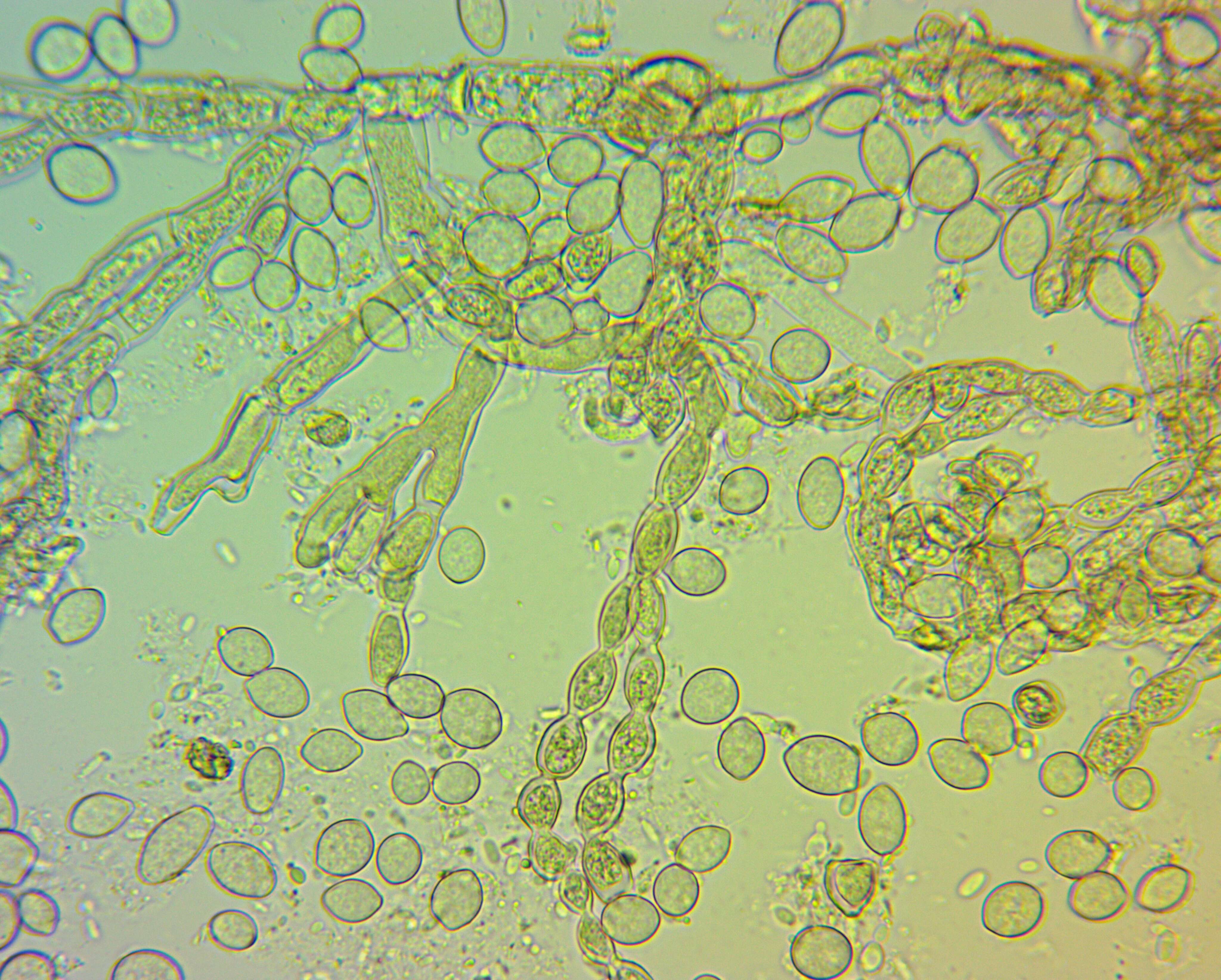 Sivun Monilinia fructicola (G. Winter) Honey 1928 kuva