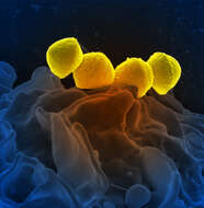 Image of Streptococcus pyogenes