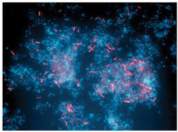 Image of gram-positive bacteria