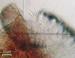 Image of Lecanoromycetidae