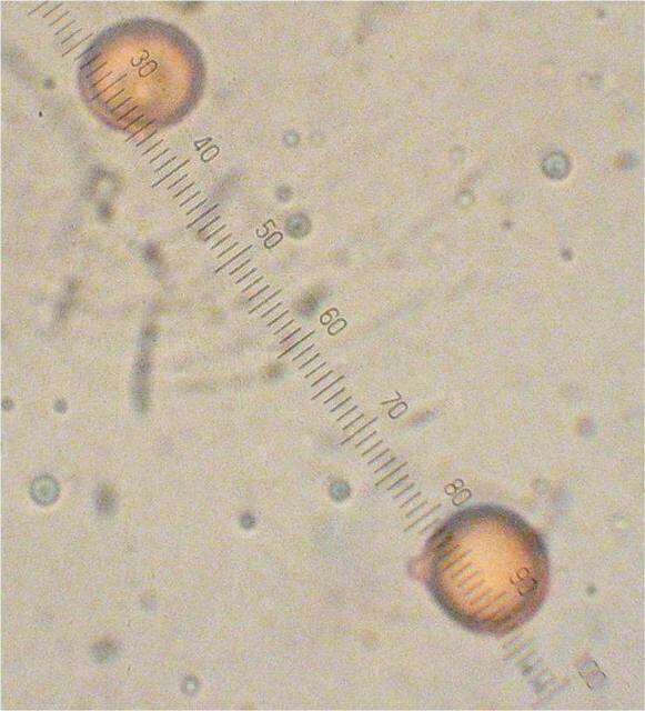 Image of Umber-zoned ringless amanita