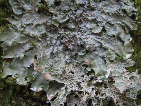 Image of lung lichen