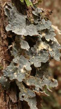 Image of lung lichen