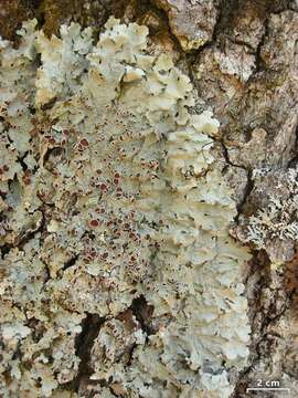 Image of lung lichen