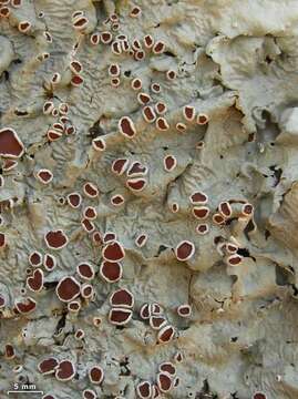 Image of lung lichen