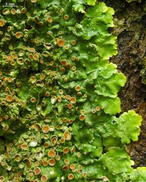 Image of lung lichen