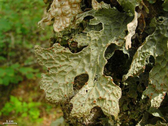 Image of lung lichen