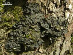 Image of skin lichen