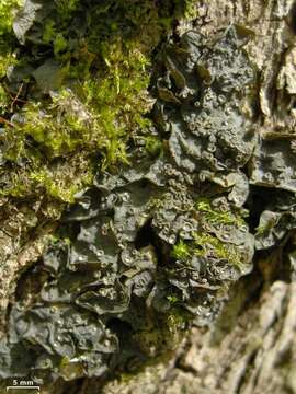 Image of skin lichen