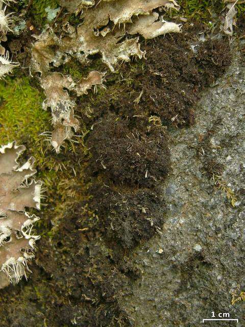 Image of skin lichen