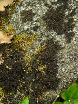 Image of skin lichen