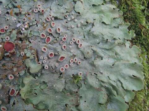 Image of lung lichen