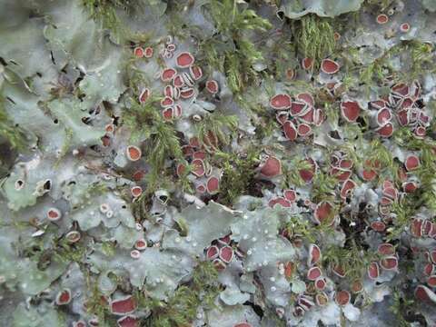 Image of lung lichen