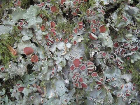 Image of lung lichen