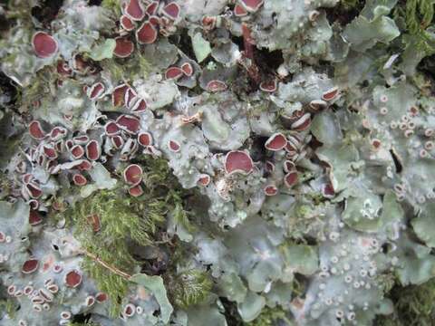 Image of lung lichen