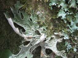 Image of lung lichen