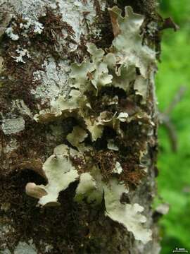 Image of lung lichen