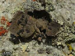 Image of navel lichen