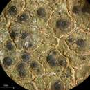 Image of wart lichen