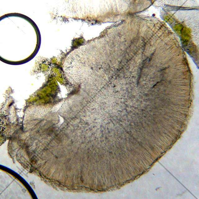 Image of biatora lichen