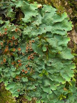 Image of lung lichen