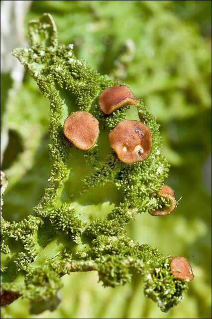 Image of lung lichen