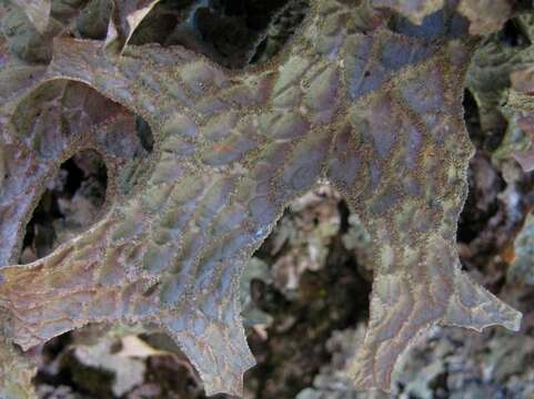 Image of lung lichen